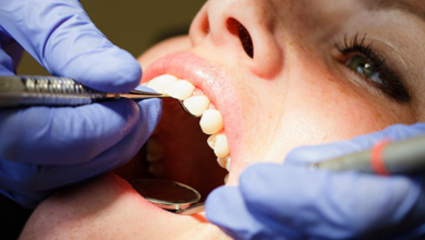 Deep Teeth Cleaning