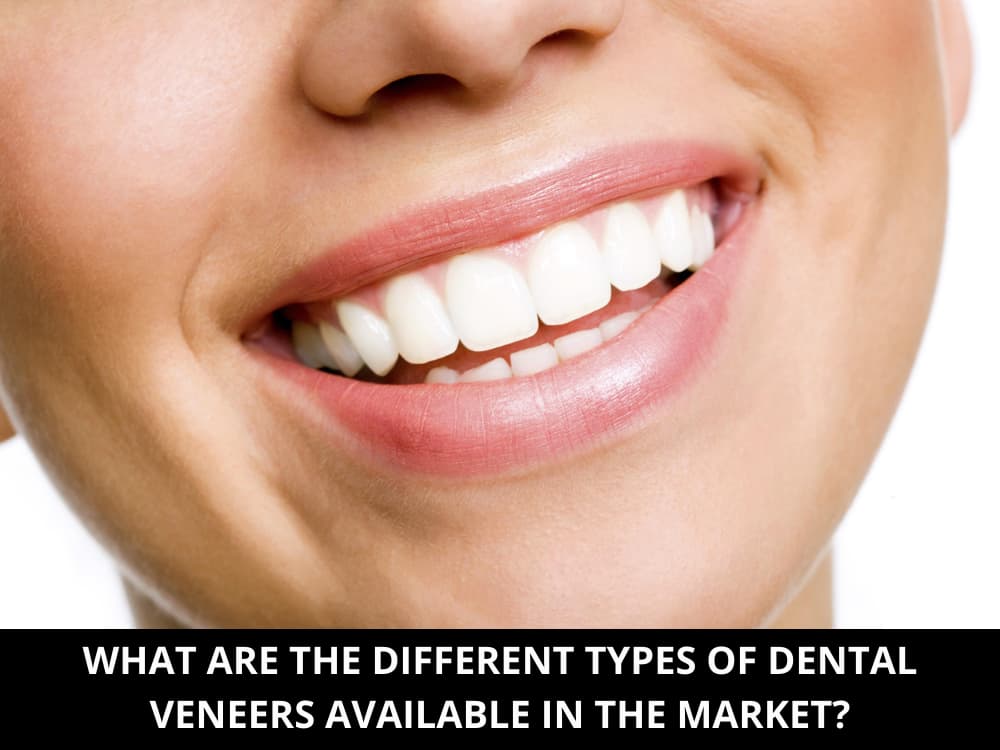 What Are the Different Types of Dental Veneers Available in the Market_